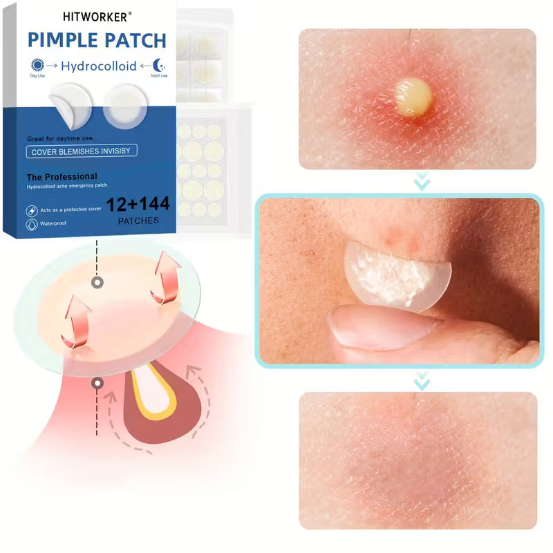 HITWORKER Hydrocolloid Patches