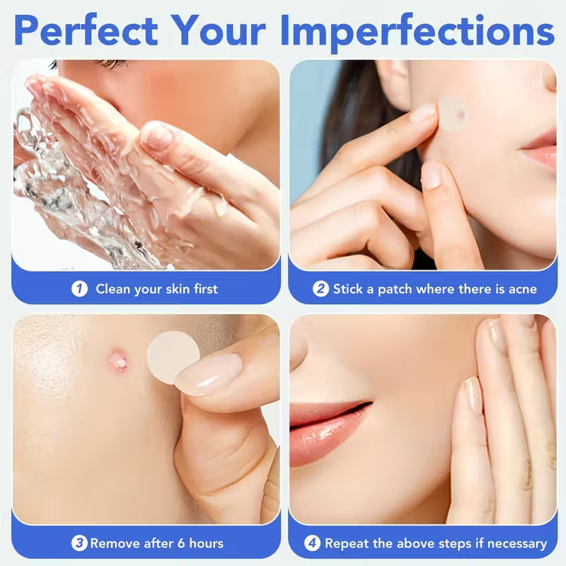 HITWORKER Hydrocolloid Patches